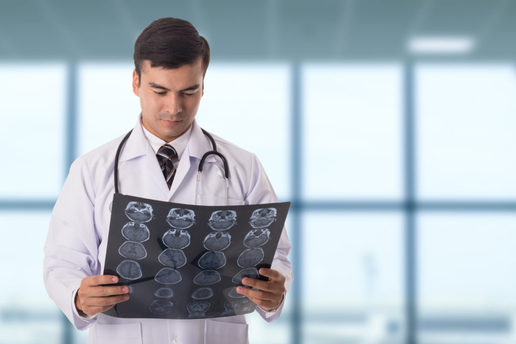 finding-the-right-neurology-expert-witness-elite-medical-experts