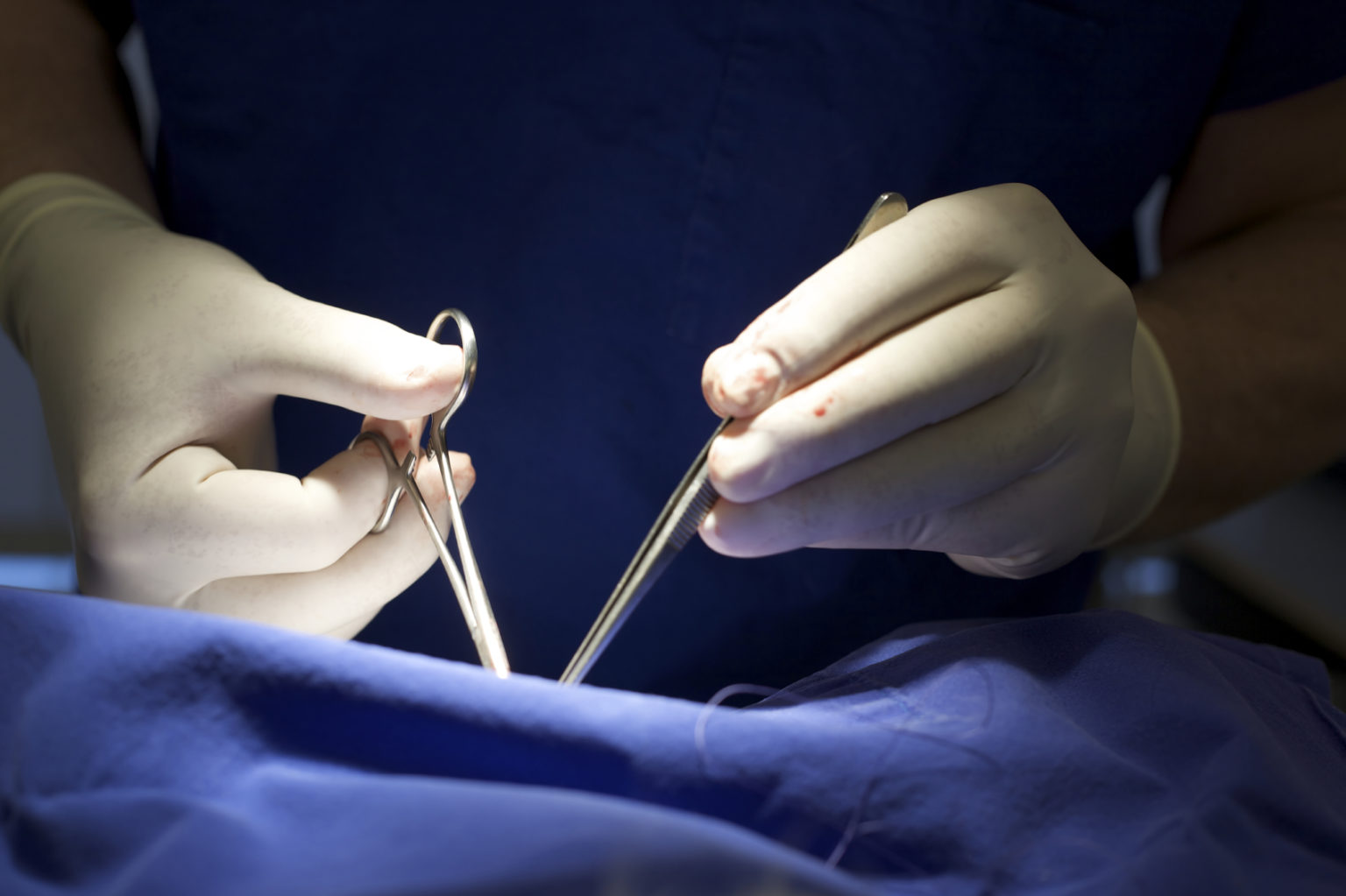 New Guidelines On Overlapping Surgeries - Elite Medical Experts