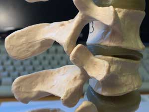 Lumbar spine surgical anatomy