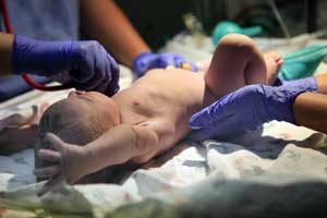 Neonatology team caring for newborn