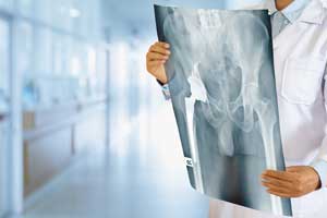 Orthopedic Surgeon studying hip X-Ray